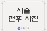전후 